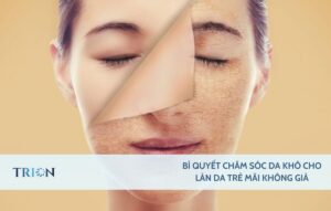 Bí quyết chăm sóc da khô cho làn da trẻ mãi không già